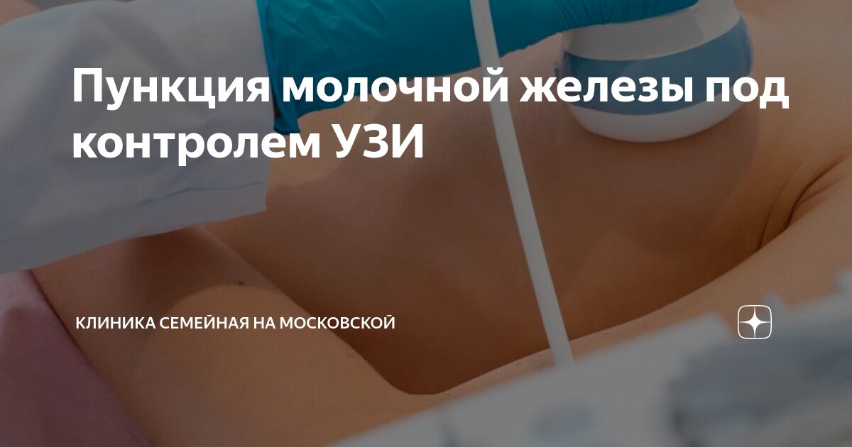 Пункция молочной железы под контролем УЗИ | Клиника Семейная на ...