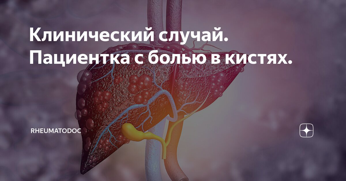 Не занимайтесь самолечением обратитесь к врачу. В случае возникновения вопросов письмо. В случае возникновения обращайтесь. В случае возникновения обращайтесь. При возникновении вопросов обращаться.