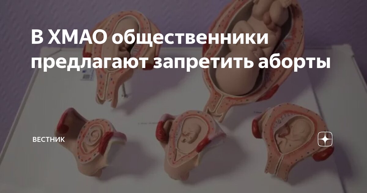 Как сделать комментарии в телеграмм. Подключить к телеграмм комментарии. Как написать от имени группы в телеграмме. Телеграмм комментарии. Запрещённые группы в телеграмме.