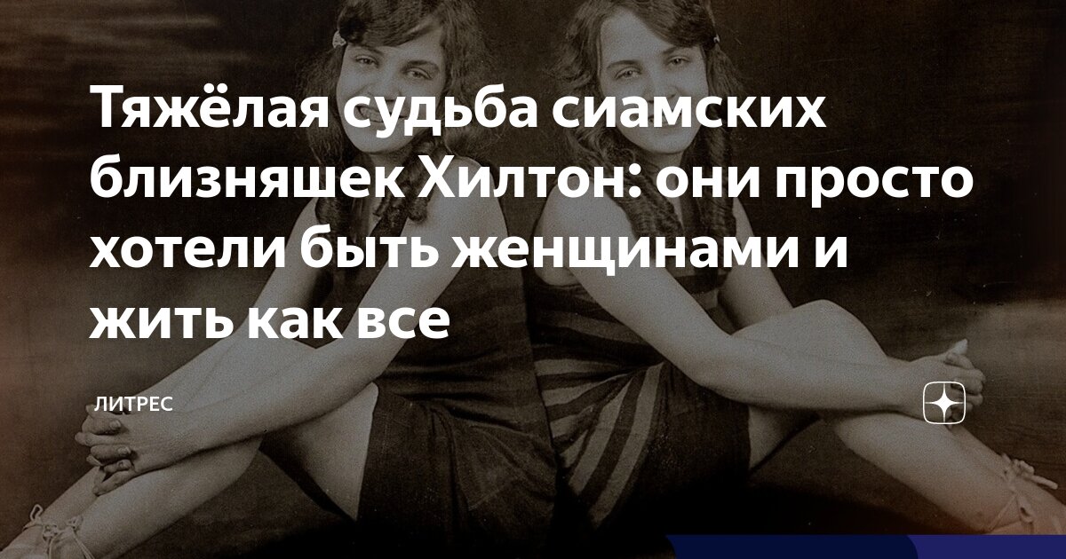 Дизиготные близнецы развиваются. Судьба близнецов. Картинка разные судьбы близнецов. Двойняшки евреи. Twins of destiny.