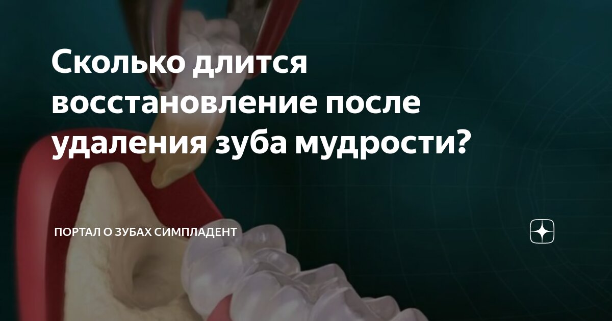 Сколько будут болеть зубы после