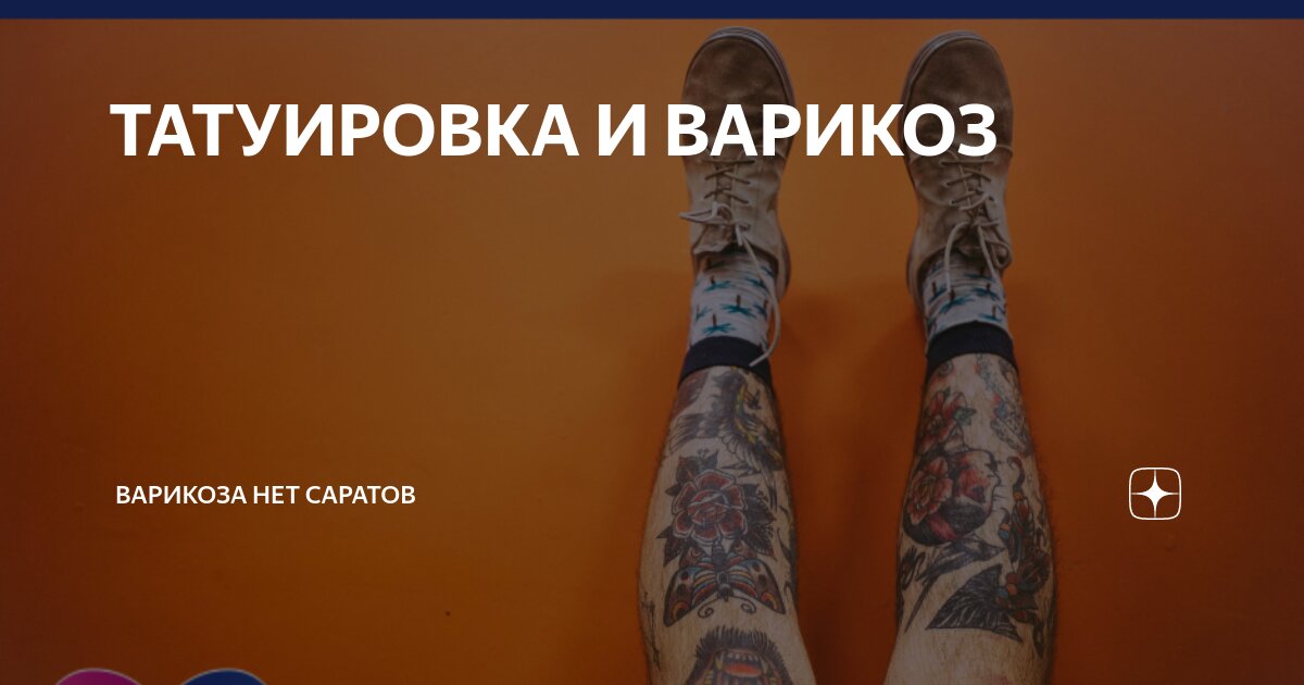 Флеболог рассказала, чем опасны тату на ногах при варикозе - Новости Калининграда