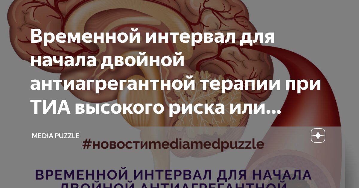 Причины инсульта у женщин в молодом возрасте. Ишемический инсульт у молодых. Инсульт у молодых. Ишемический инсульт у молодых. Причины инсульта в молодом возрасте у мужчин.
