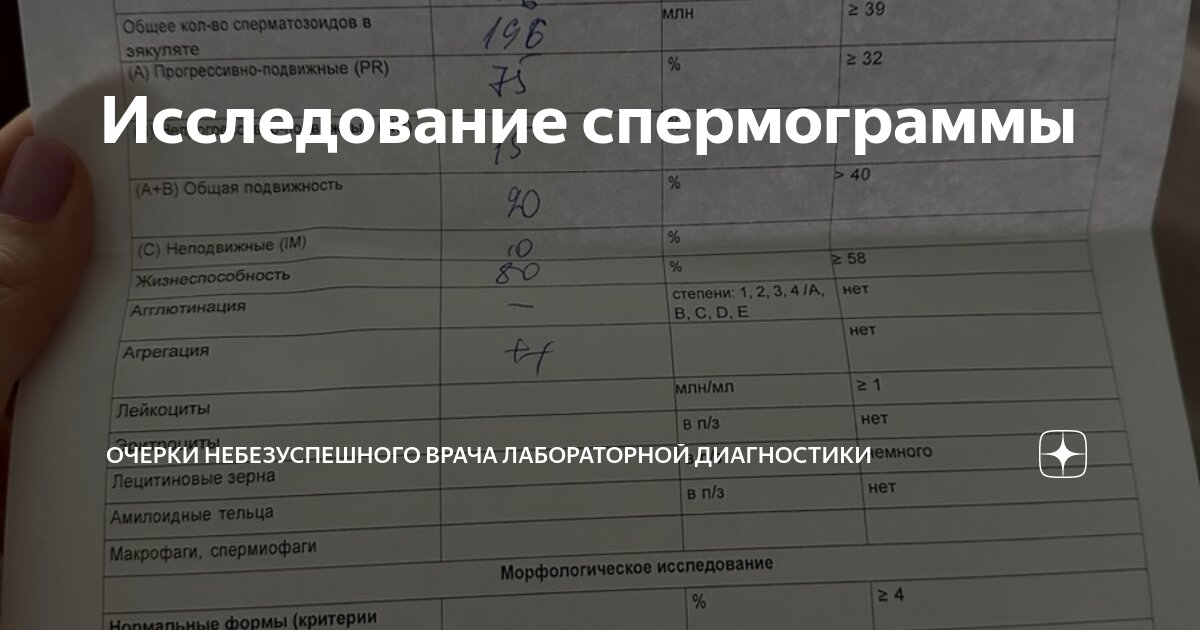 Подвижность спермы: что нужно знать об этом? Как увеличить показатель?