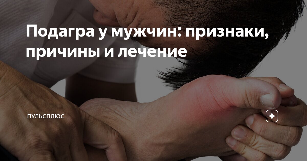 ооо "пульс плюс". логотип ооо пульс. кардиограмма сердца. пульс плюс. пульс плюс.