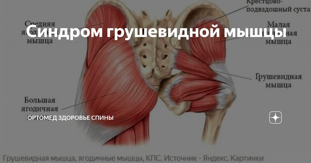 Показать грушевидную мышцу