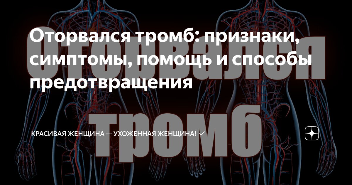Оторвался тромб: признаки, симптомы, помощь и способы предотвращения ...