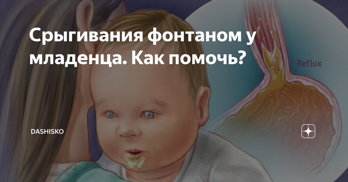 Частые срыгивания у малышей: норма или нет?