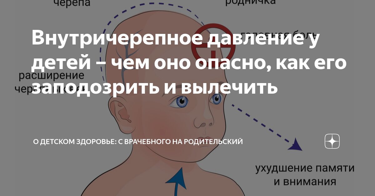 Внутричерепное давление у взрослых