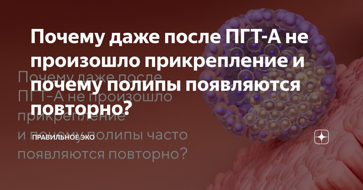 Что такое пгт при эко. Что такое пгт при эко