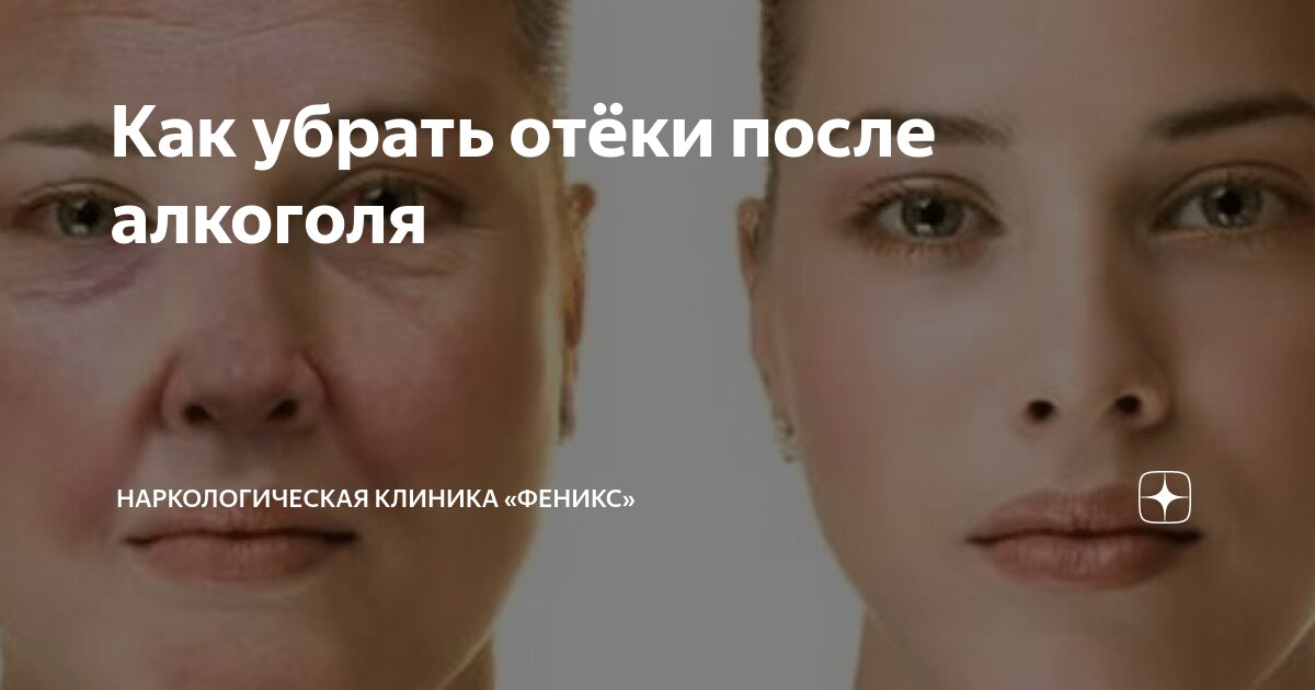 Как снять отек лица после алкоголя быстро Как снять отек лица после алкоголя быстро