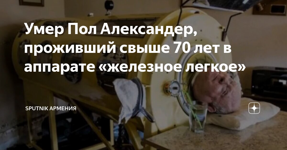 Умер Пол Александер, проживший свыше 70 лет в аппарате «железное легкое ...