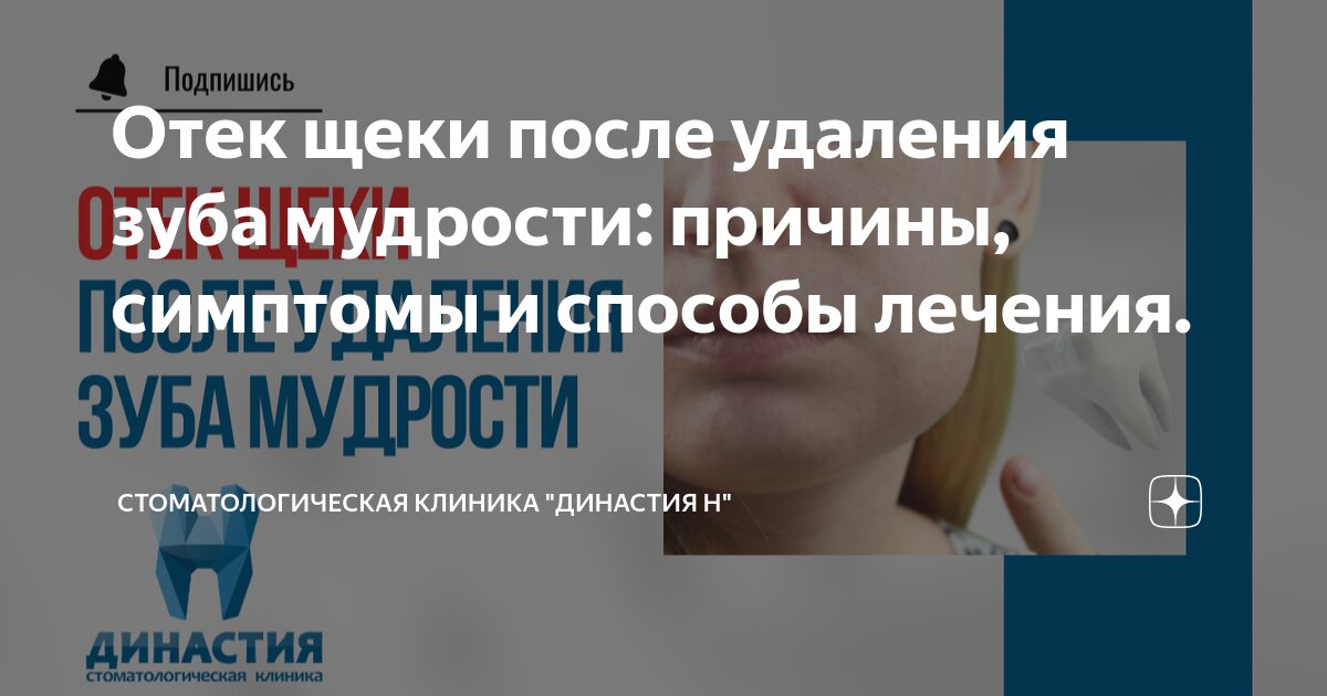Отек после удаления зуба мудрости
