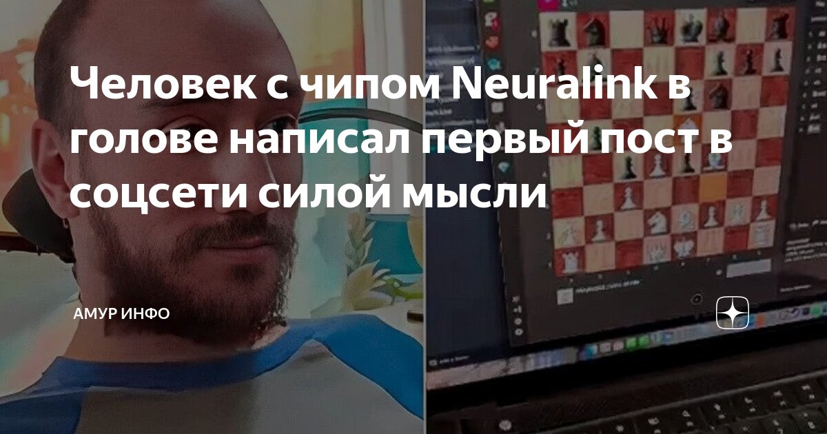 Человек с чипом Neuralink в голове написал первый пост в соцсети силой ...