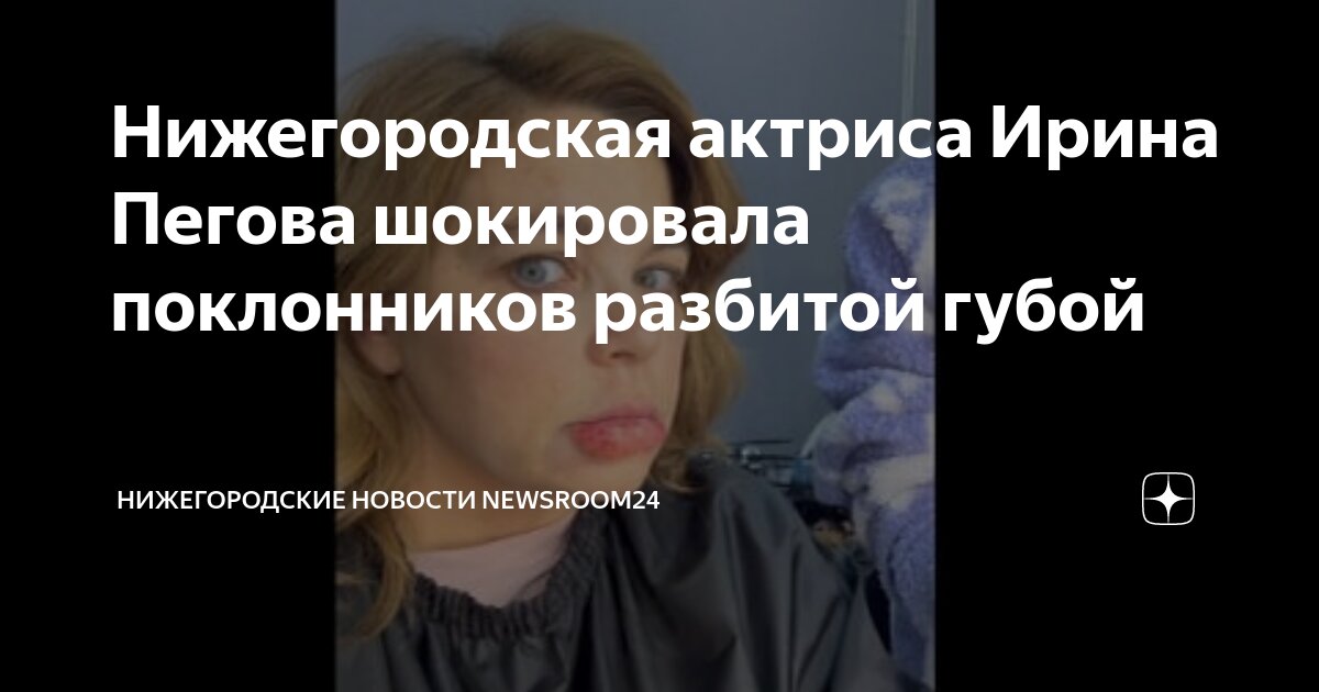 Нижегородская актриса Ирина Пегова шокировала поклонников разбитой губой