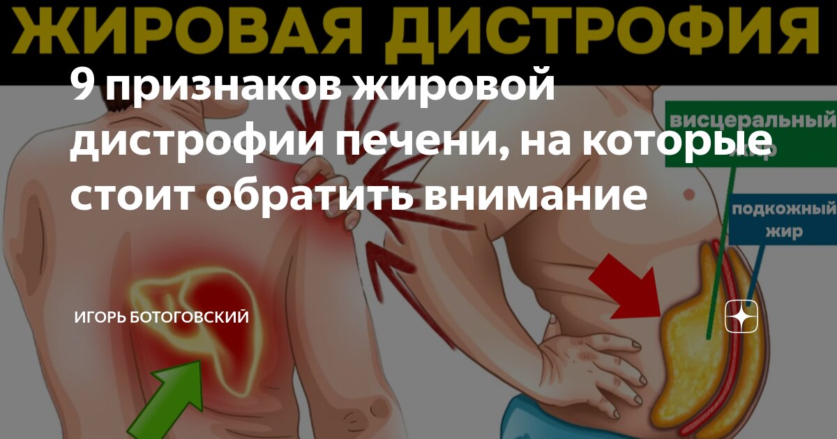 Жировая болезнь печени – симптомы, стадии и лечение жирового гепатоза в Москве в «СМ-Клиника»