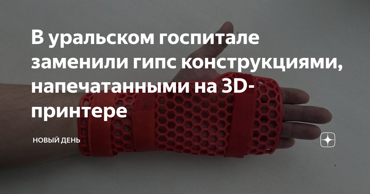 В уральском госпитале заменили гипс конструкциями, напечатанными на 3D ...