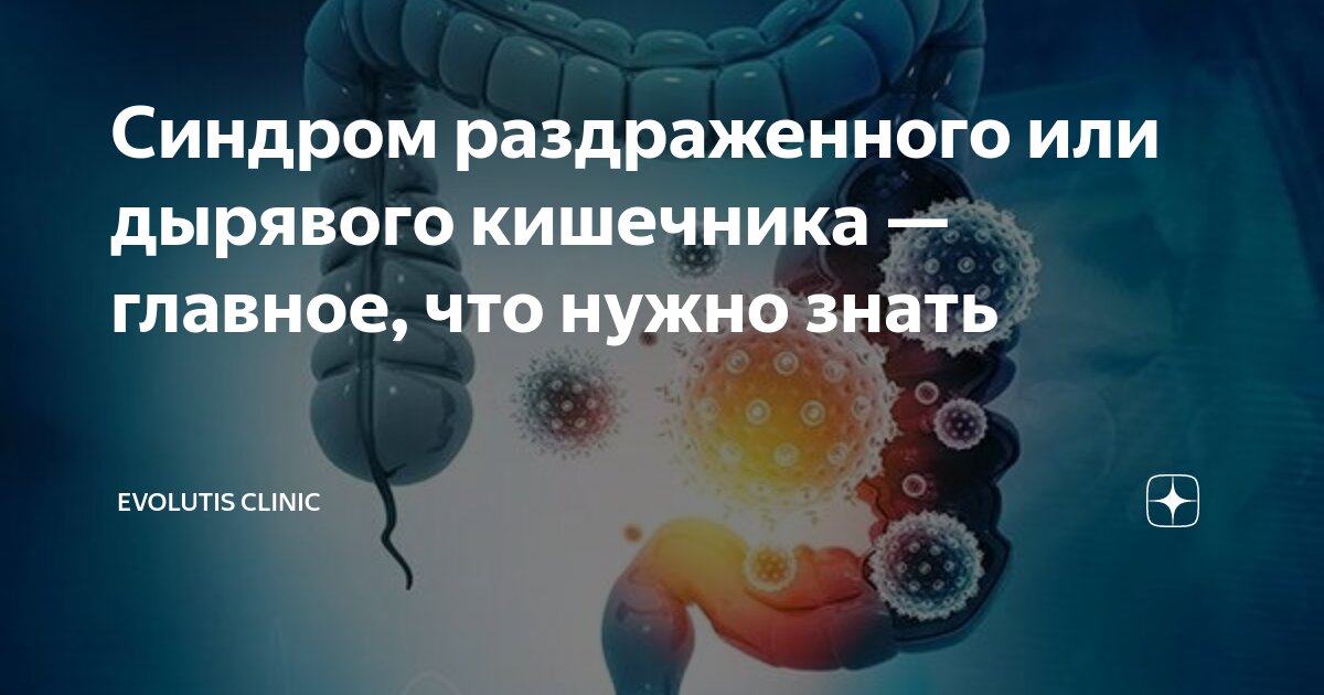 Синдром раздраженного или дырявого кишечника — главное, что нужно знать ...