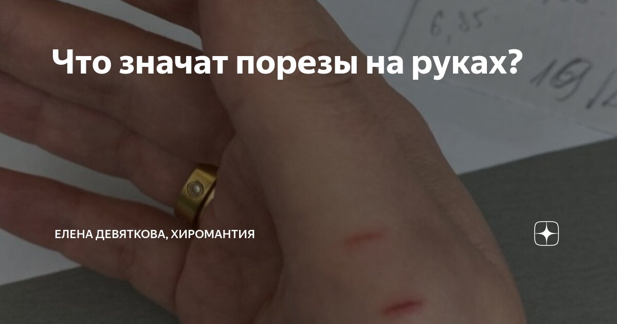 Что значат порезы на руках? | Елена Девяткова, хиромантия | Дзен