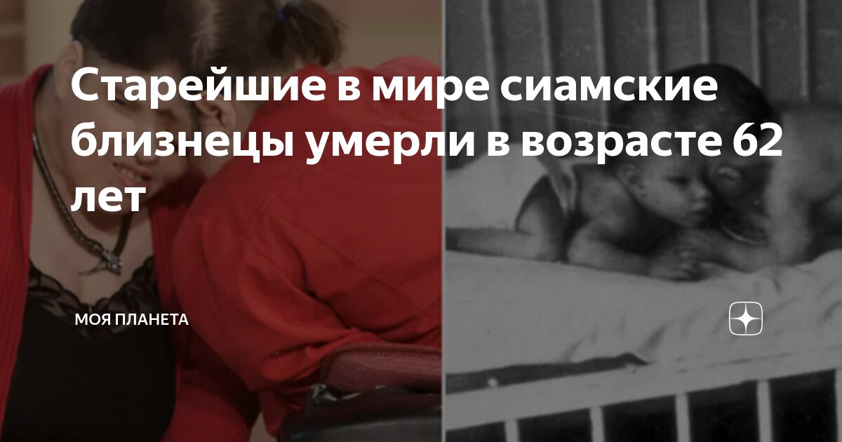 Старейшие в мире сиамские близнецы умерли в возрасте 62 лет | МОЯ ...