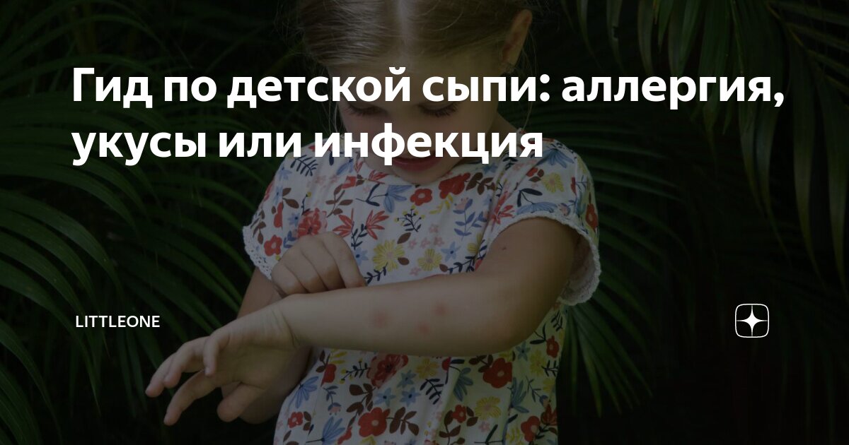 Гид по детской сыпи: аллергия, укусы или инфекция | Littleone | Дзен