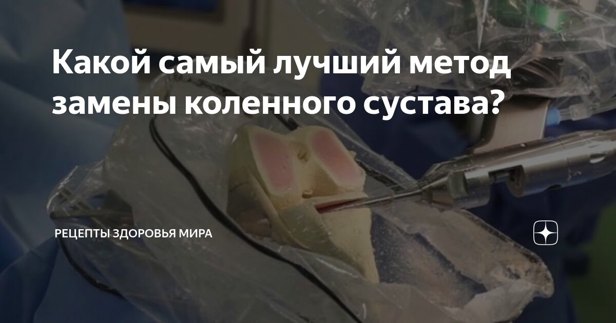 как правильно ходить на костылях после замены коленного сустава