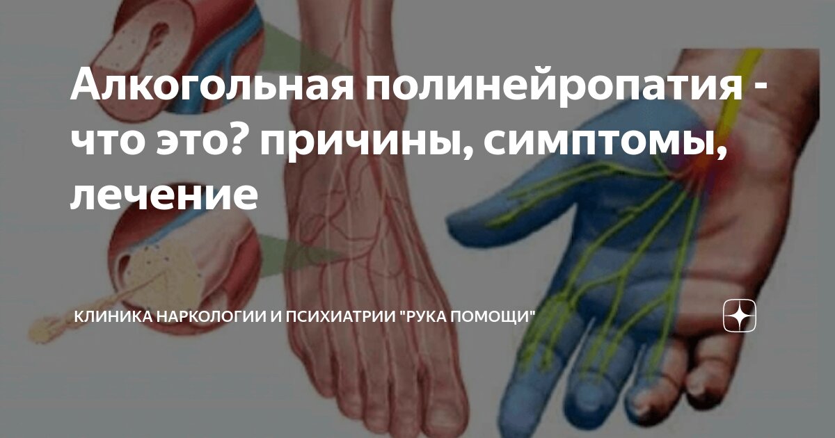 Алкогольная полинейропатия - что это? причины, симптомы, лечение ...