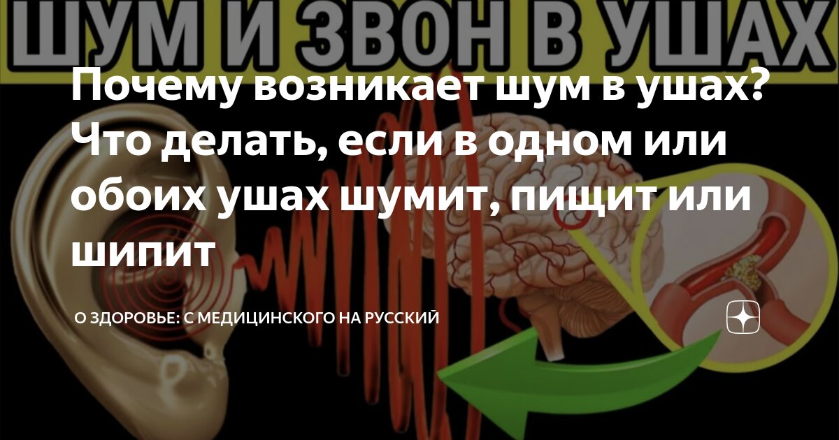 Как избавиться от шума в ушах и голове народными средствами?