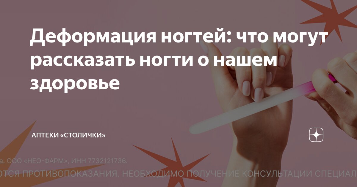 Деформация ногтей: что могут рассказать ногти о нашем здоровье | Аптеки ...