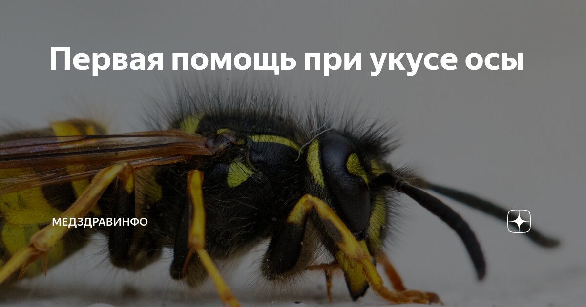 Первая помощь при укусе осы | МедЗдравИнфо | Дзен