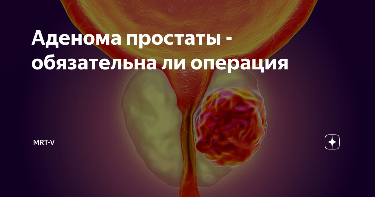 операция аденома простаты цена
