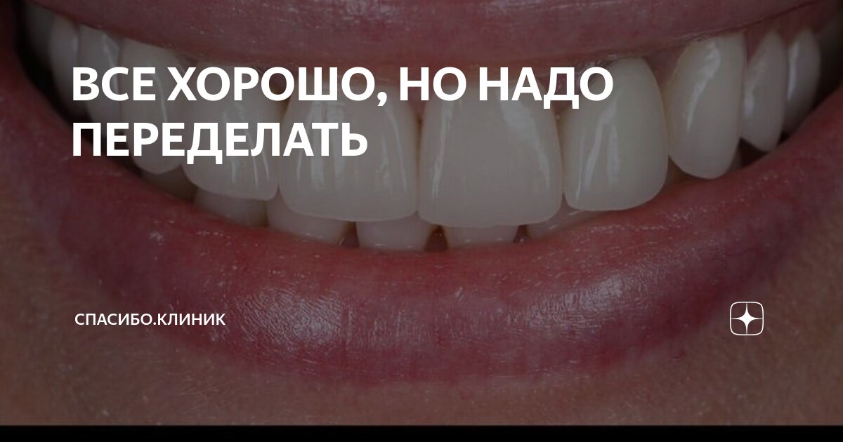 ВСЕ ХОРОШО, НО НАДО ПЕРЕДЕЛАТЬ | Спасибо.Клиник | Дзен