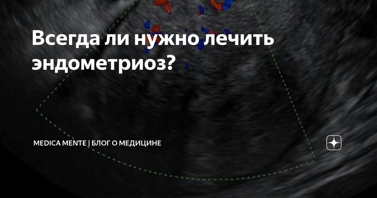 как ставить свечи лонгидаза при эндометриозе