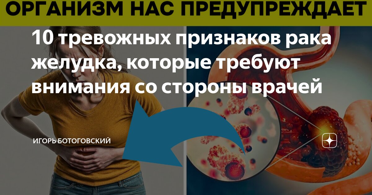 10 тревожных признаков рака желудка, которые требуют внимания со ...