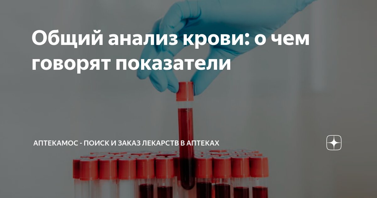 можно ли кушать при сдачи общего анализа крови
