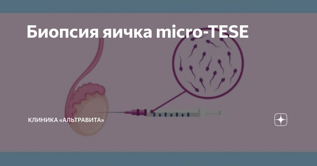 Патоспермия что это. Патоспермия что это