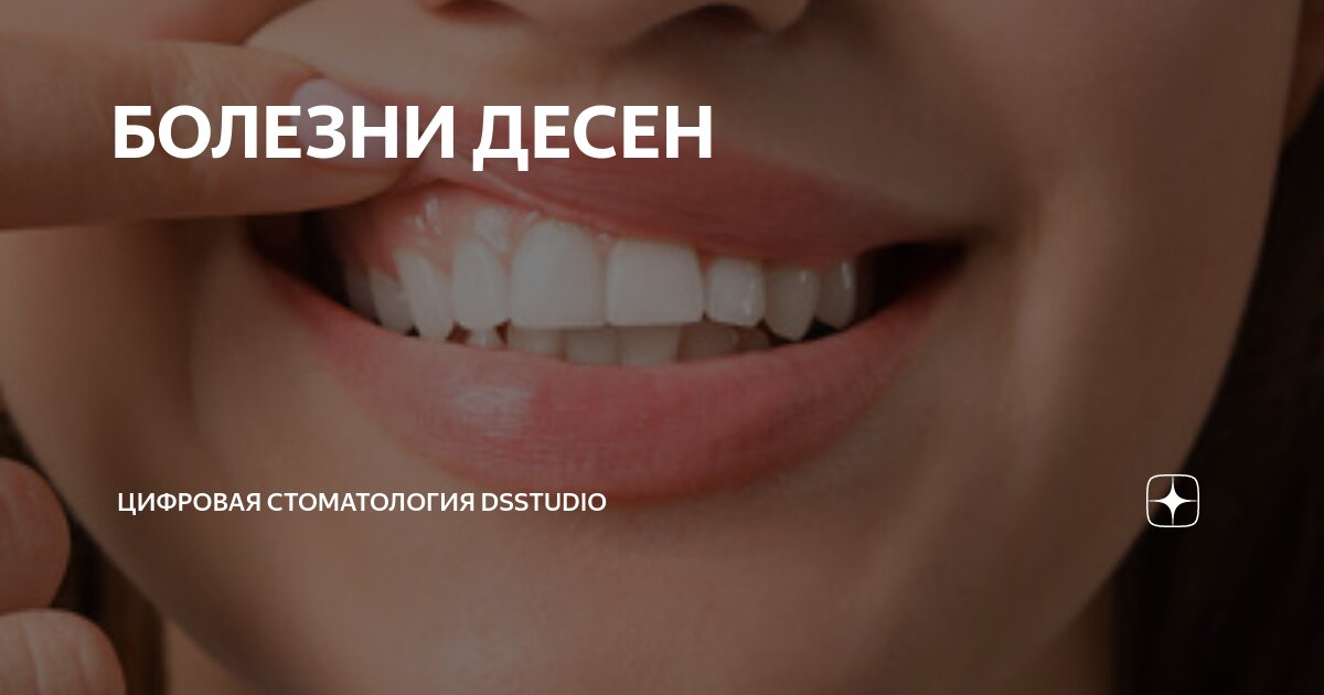 болезни десен у взрослых