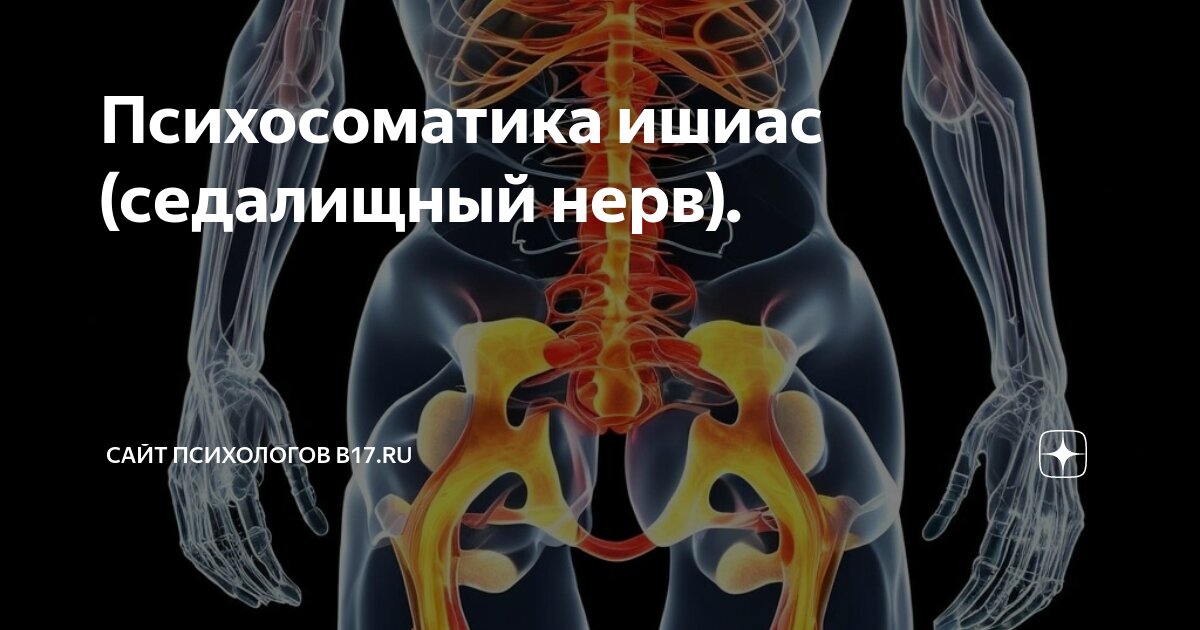 Психосоматика ишиас (седалищный нерв). | Сайт психологов b17.ru | Дзен