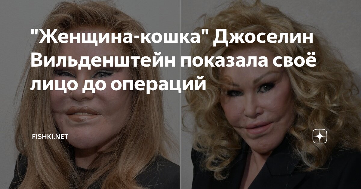 "Женщина-кошка" Джоселин Вильденштейн показала своё лицо до операций ...