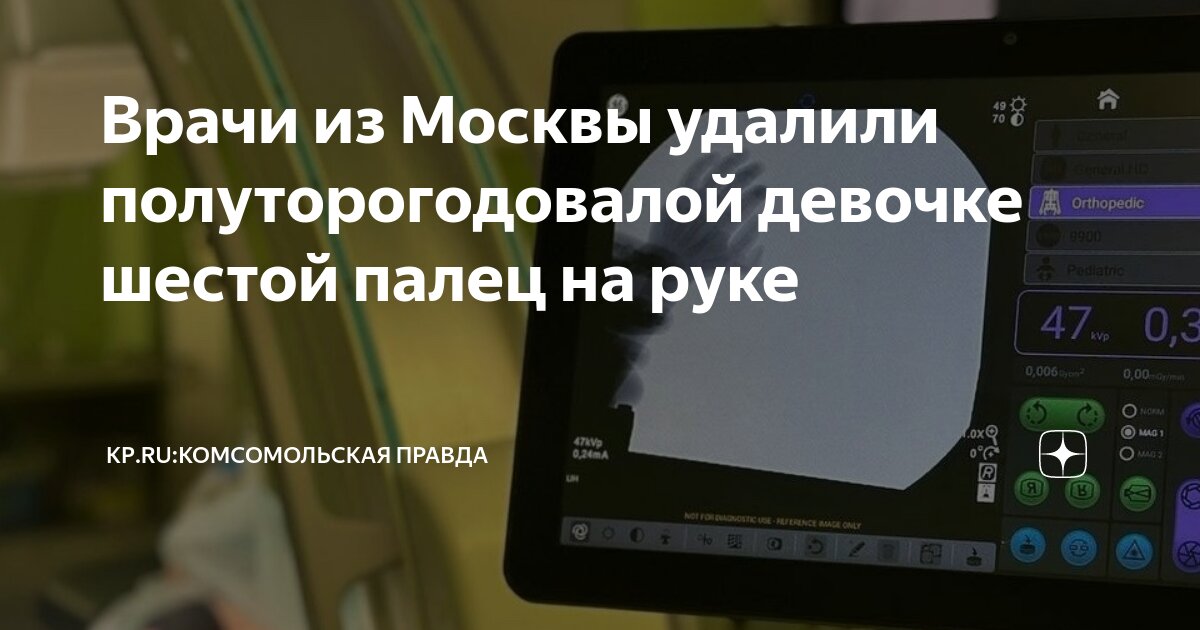 Как удалить палец. Как удалить палец