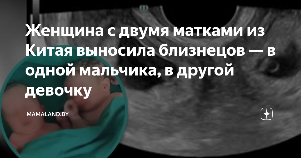 Мальчик и девочка могут быть близнецами. Мальчик и девочка могут быть близнецами