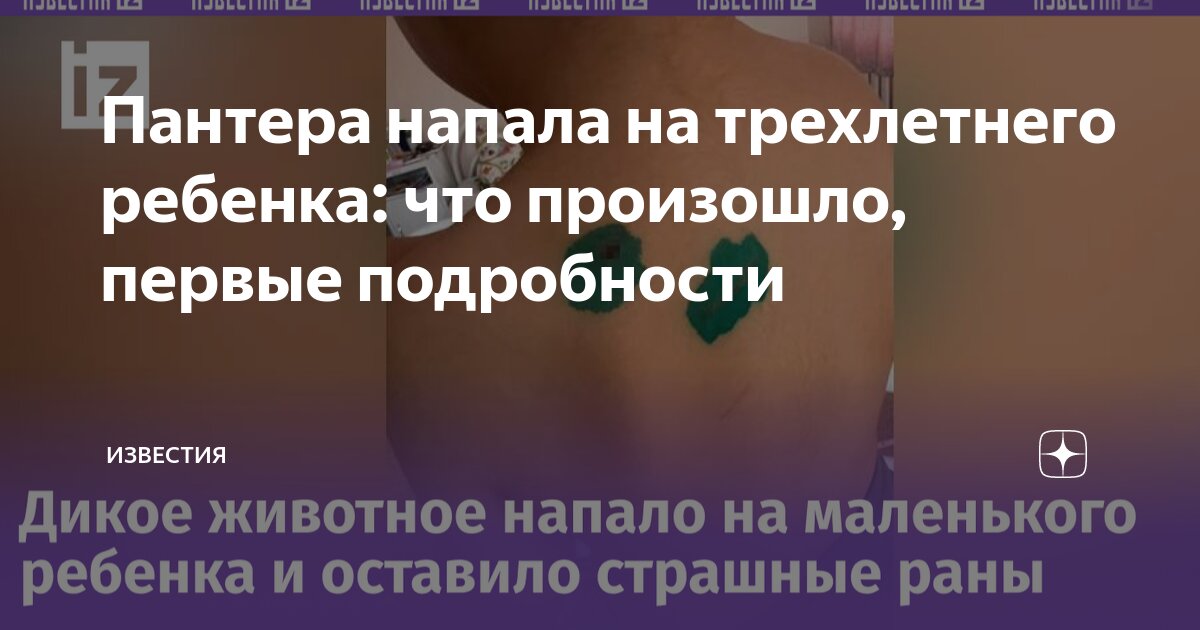 Цирковая пантера напала на ребенка. Цирковая пантера напала на ребенка. Цирковая пантера напала на ребенка. Цирковая пантера напала на ребенка. Цирковая пантера напала на ребенка.