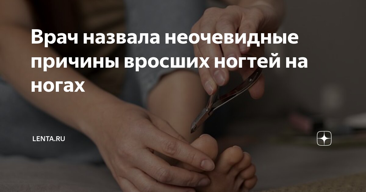 Врач назвала неочевидные причины вросших ногтей на ногах | Lenta.ru | Дзен