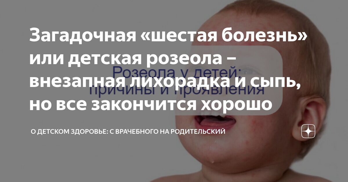 Загадочная «шестая болезнь» или детская розеола – внезапная лихорадка и ...
