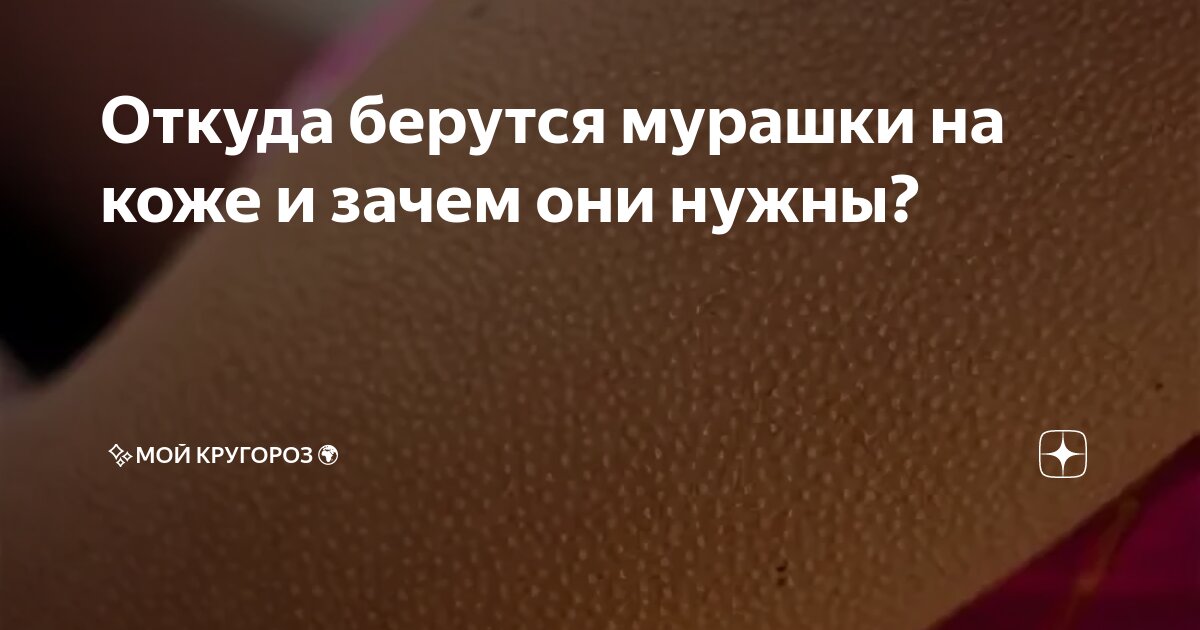 Голова покрывается мурашками