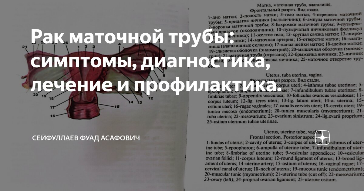 Рак маточной трубы: симптомы, диагностика, лечение и профилактика ...