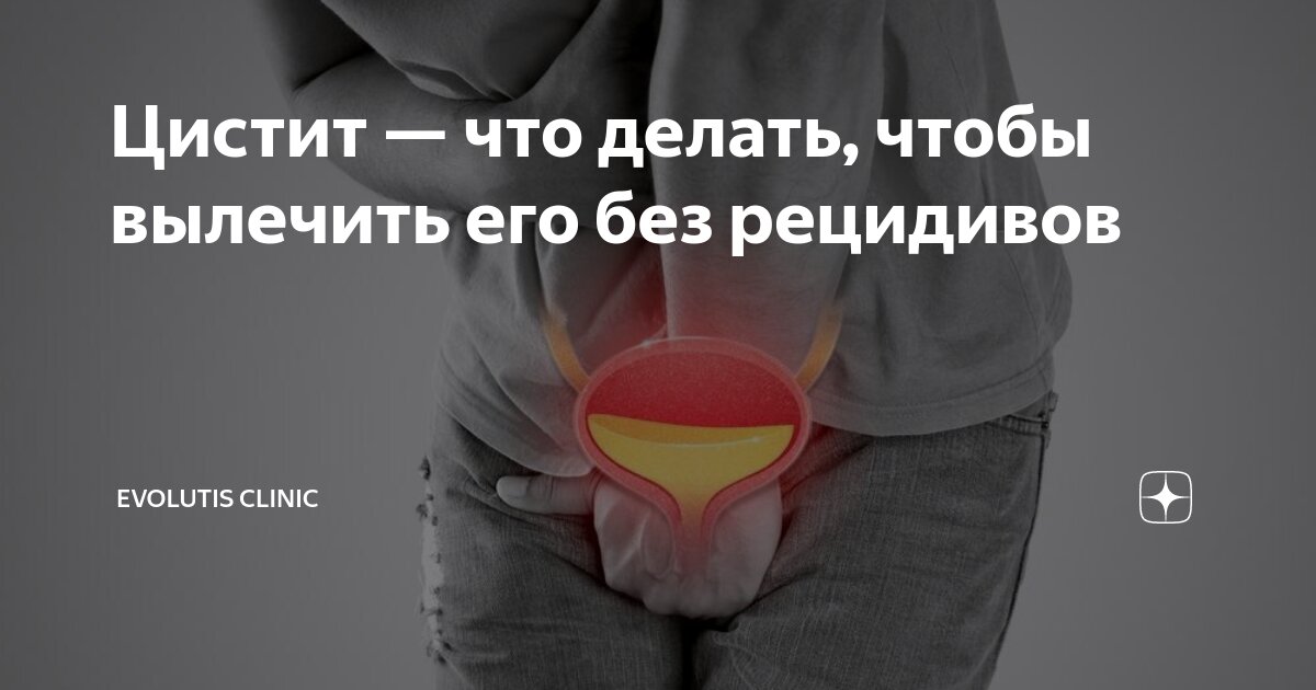 как вылечить цистит у женщин