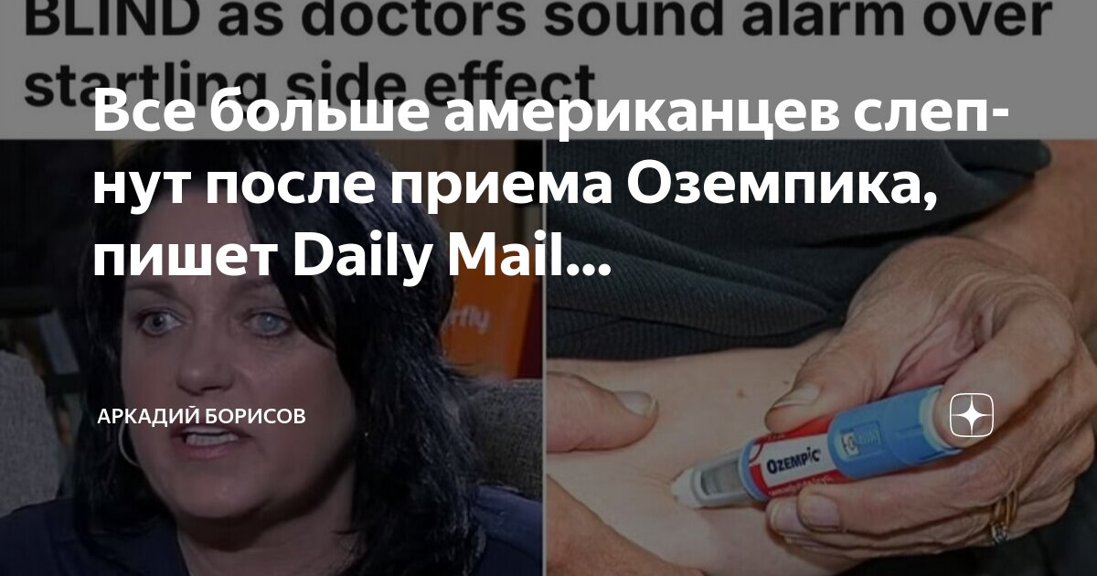 Как выглядит лицо после оземпика Все больше американцев слепнут после приема Оземпика, пишет Daily Mail. Аркадий 