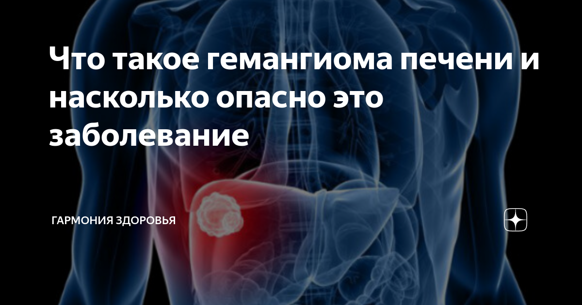 Что такое гемангиома печени. Гемангиома печени что это такое у взрослых. Питание при гемангиоме печени. Гемангиома в печени у взрослого человека. Боли при гемангиоме печени.