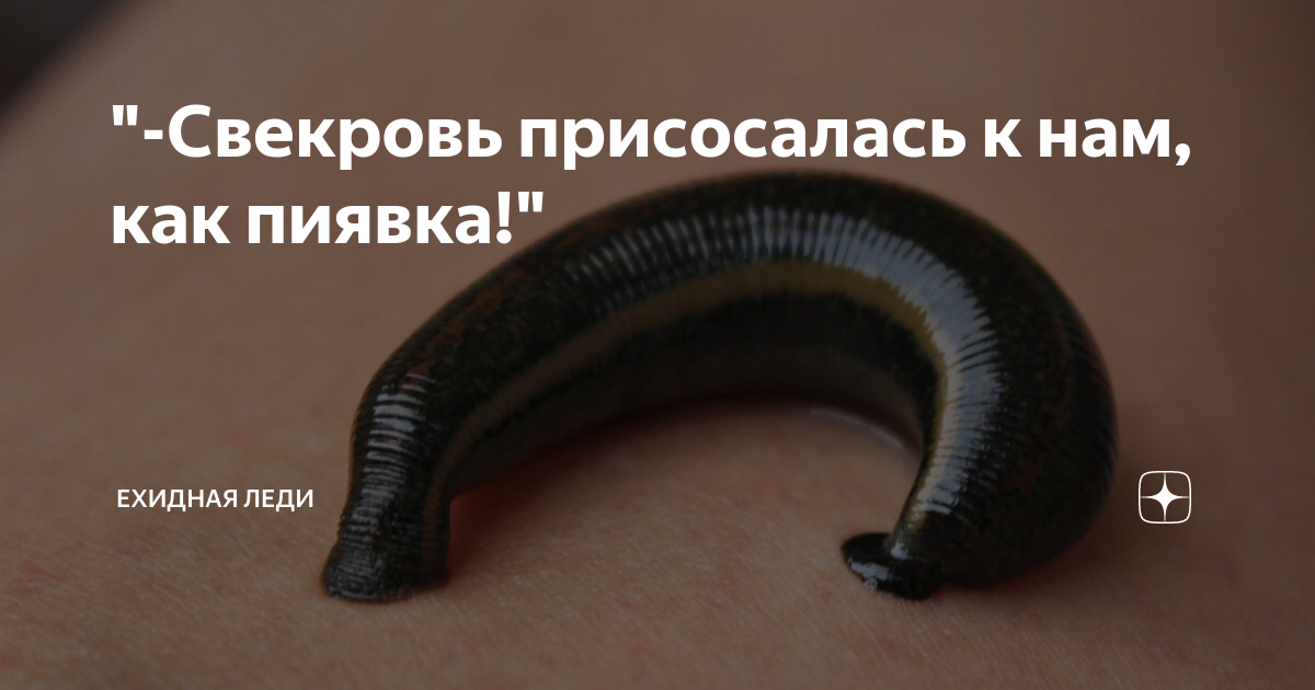 елена соловьева пиявка. постановка медицинских пиявок. пиявки гирудотерапия реклама. точки постановки пиявок на лицо. гирудотерапия лечение пиявками.